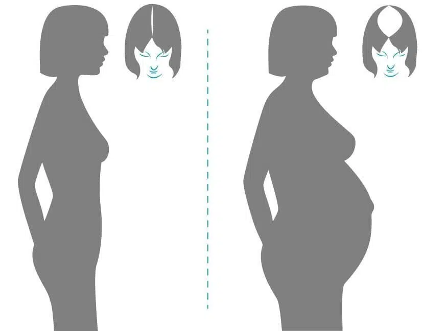 Wie beeinflußt eine Schwangerschaft die Gesundheit des Haares?