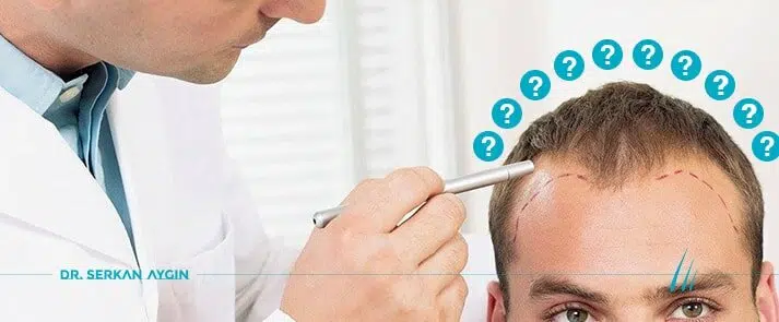 Haartransplantation Türkei – bester Arzt Dr.Serkan Aygin