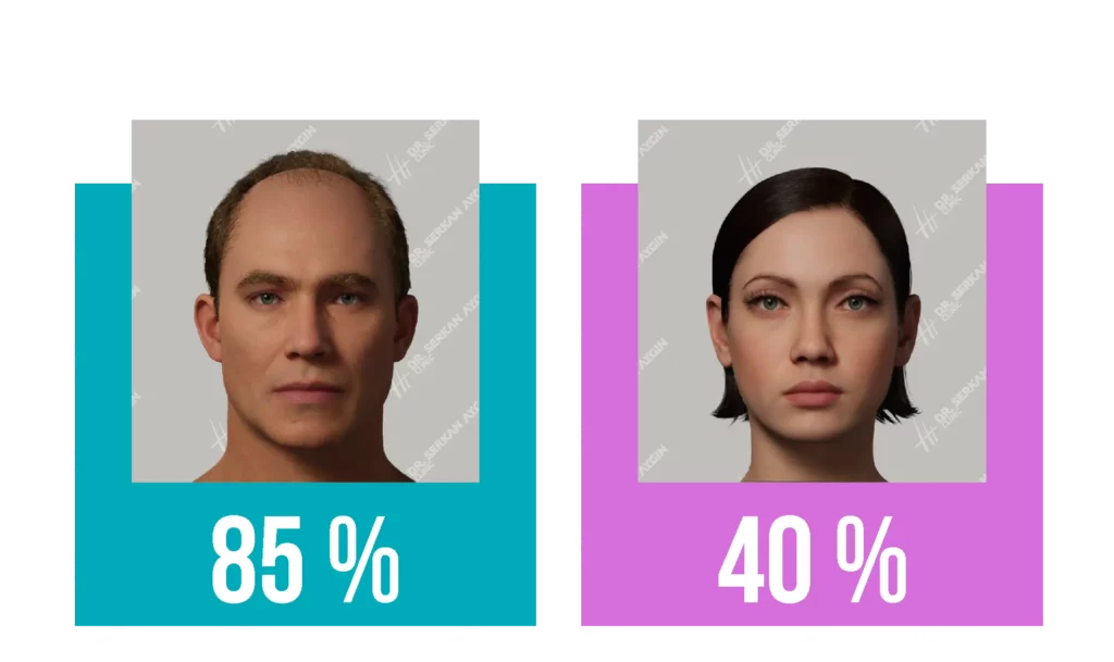 Haartransplantation Gender Ratio