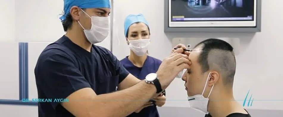 Was Müssen Sie Wissen Über Eine Haartransplantation in der Türkei