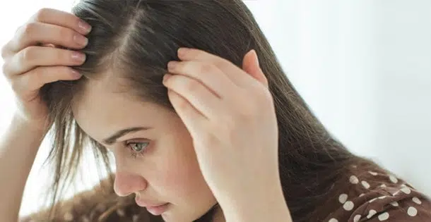 women hair loss