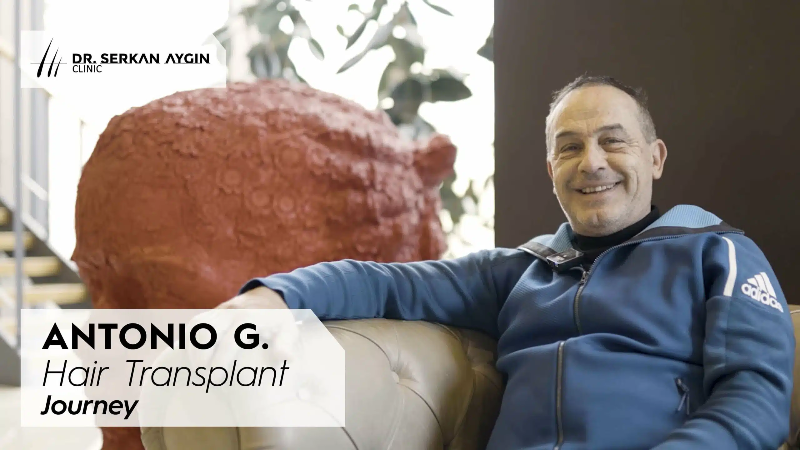 antonio g hair transplant experience