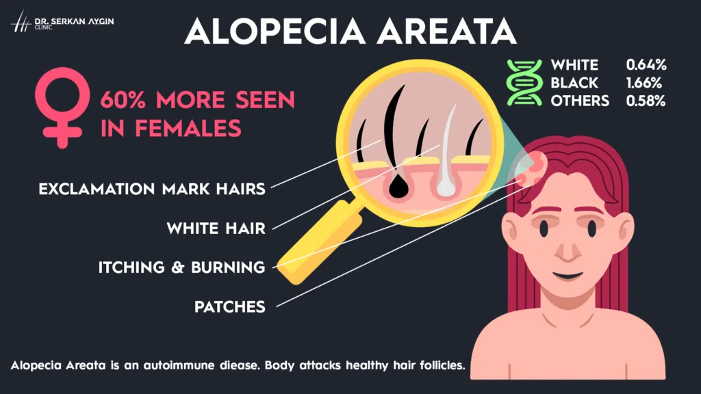 ALOPECIA AREATA