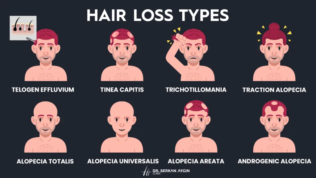 types of hair loss