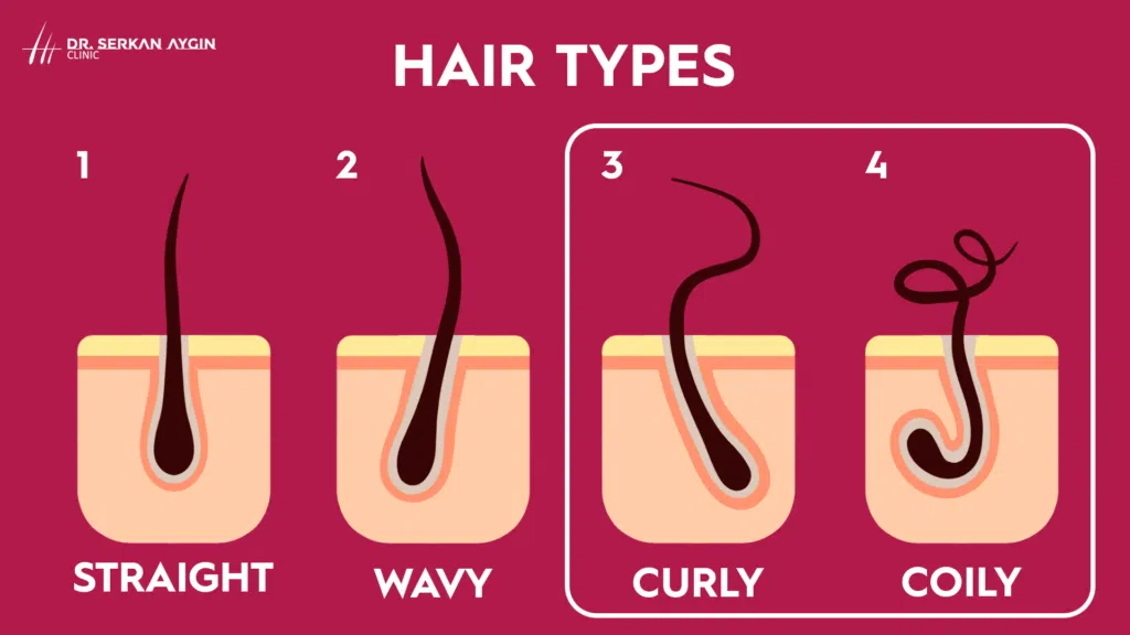 curly hair transplant, curly hair, wavy hair, hair types, hair type