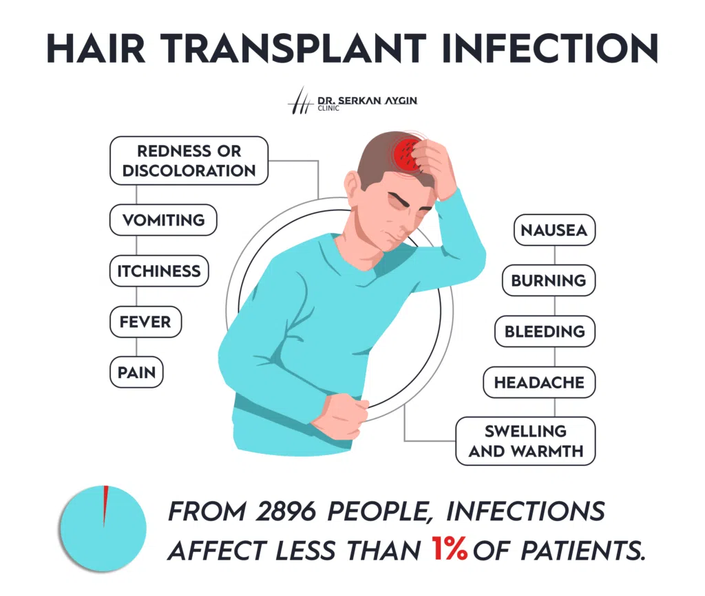 Hair transplant infection, postop hair transplant, infection after hair transplant, dr serkan aygin