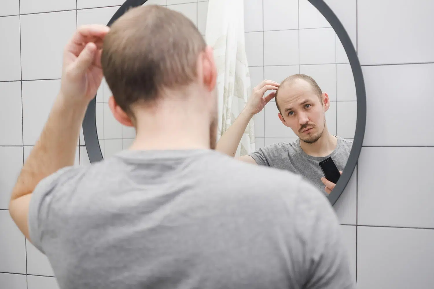 Signs of Hair loss