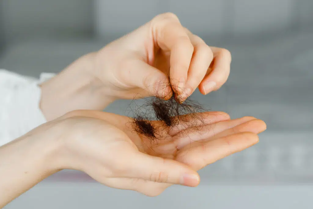 Trichotillomania