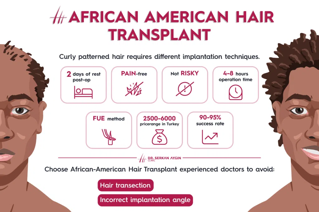 african american hair transplant, african american hair, dr serkan aygin african american hair transplant