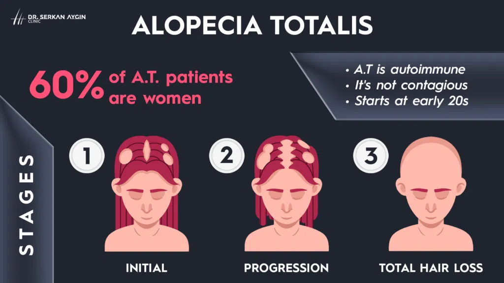 alopecia totalis