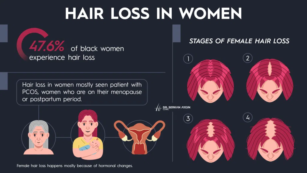 female hair loss