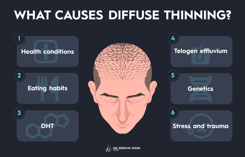 Diffuse hair thinning, thin hair transplant, thin hair, what causes diffuse hair transplant, hair transplant for thin hair, diffuse thinning hair transplant, dr serhan aygin thin hair transplant