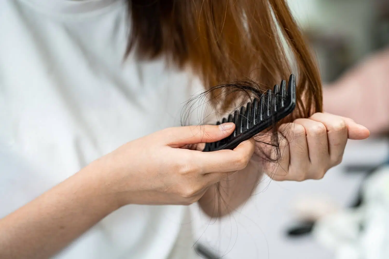 Accutane Hair Loss