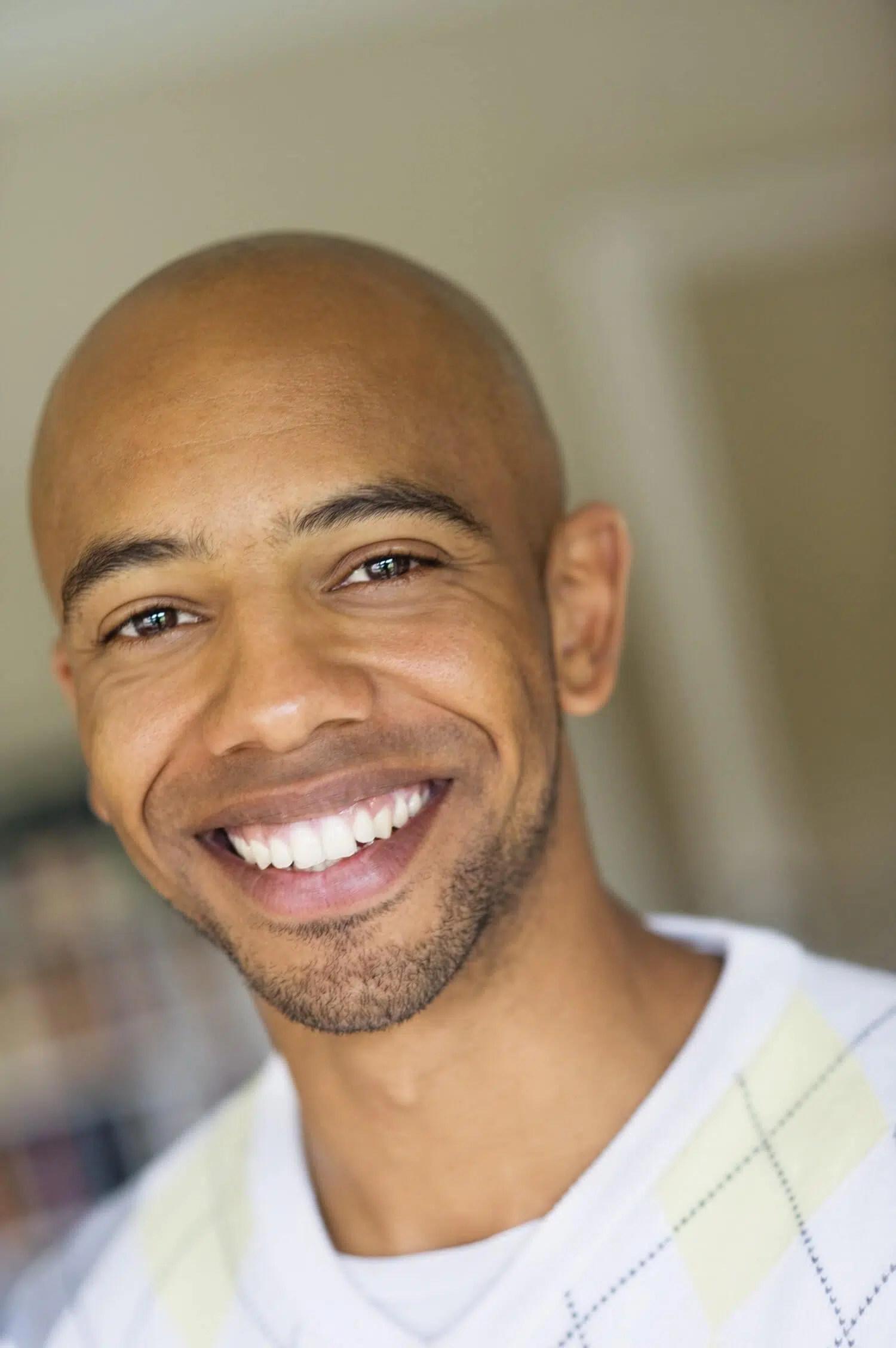 Can You Get A Hair Transplant If You Are Completely Bald