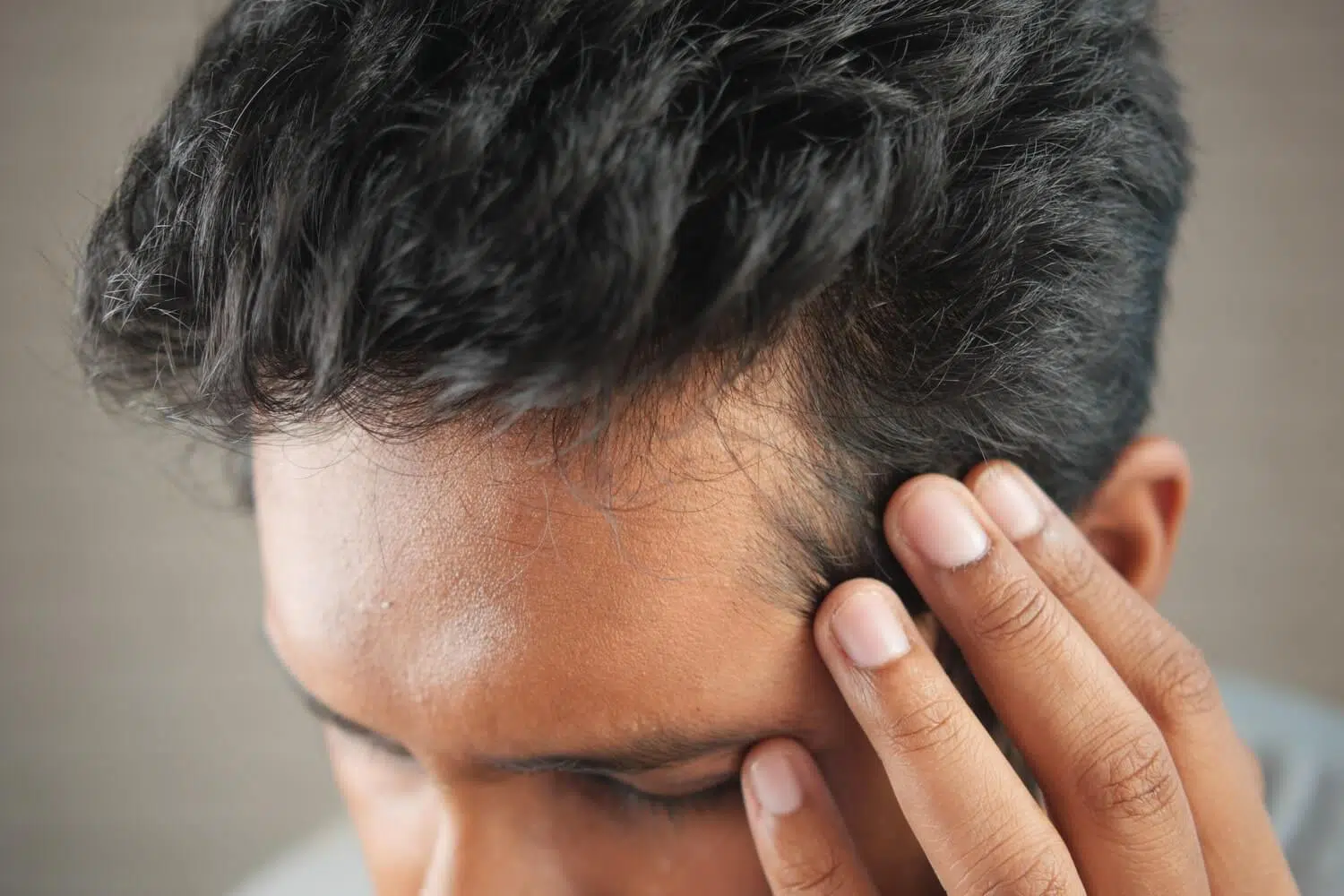 Lexapro hair loss