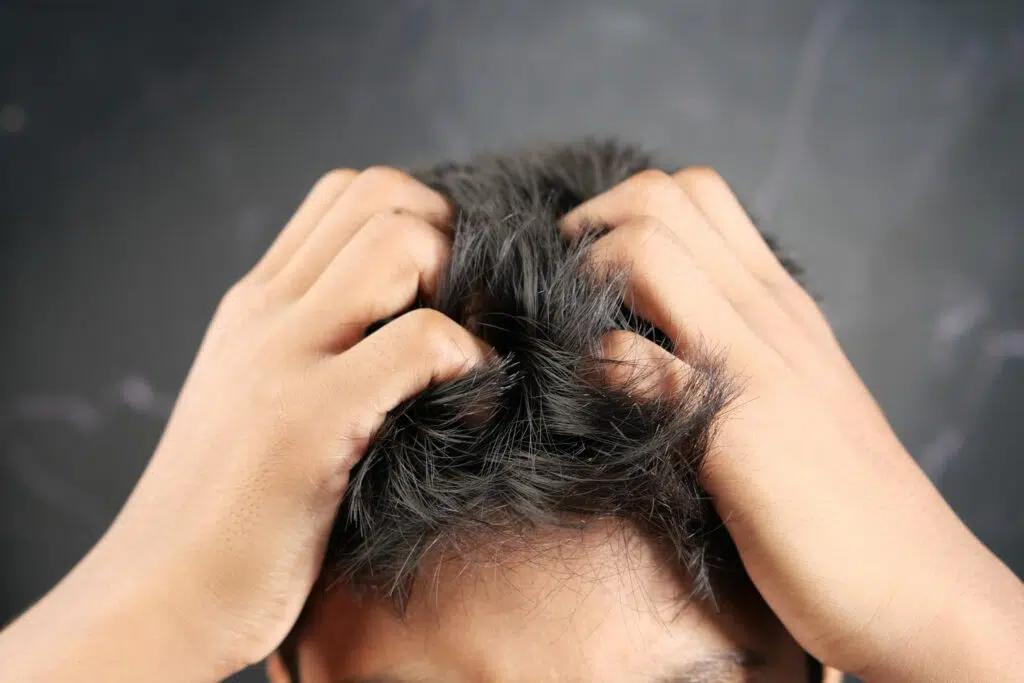 itching after hair transplant