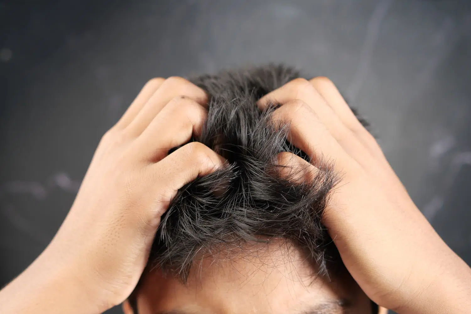itching after hair transplant