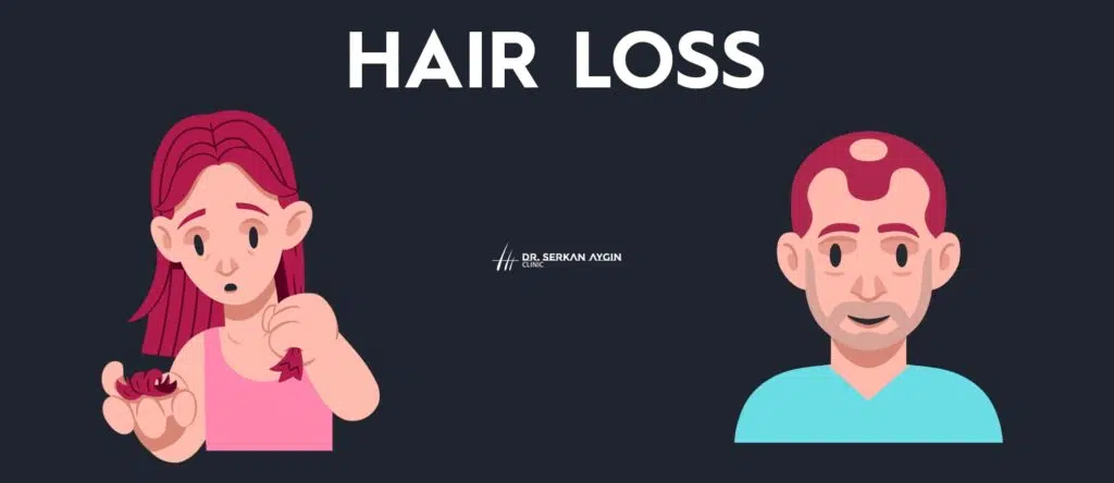 hair loss dr serkan aygin