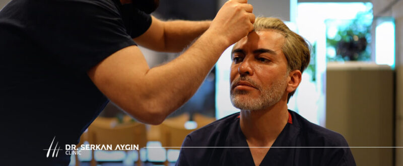 Dr. Serkan Aygın Long DHI Hair Transplant