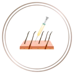 PRP against hair loss