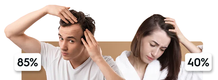 hairloss_Men_Women