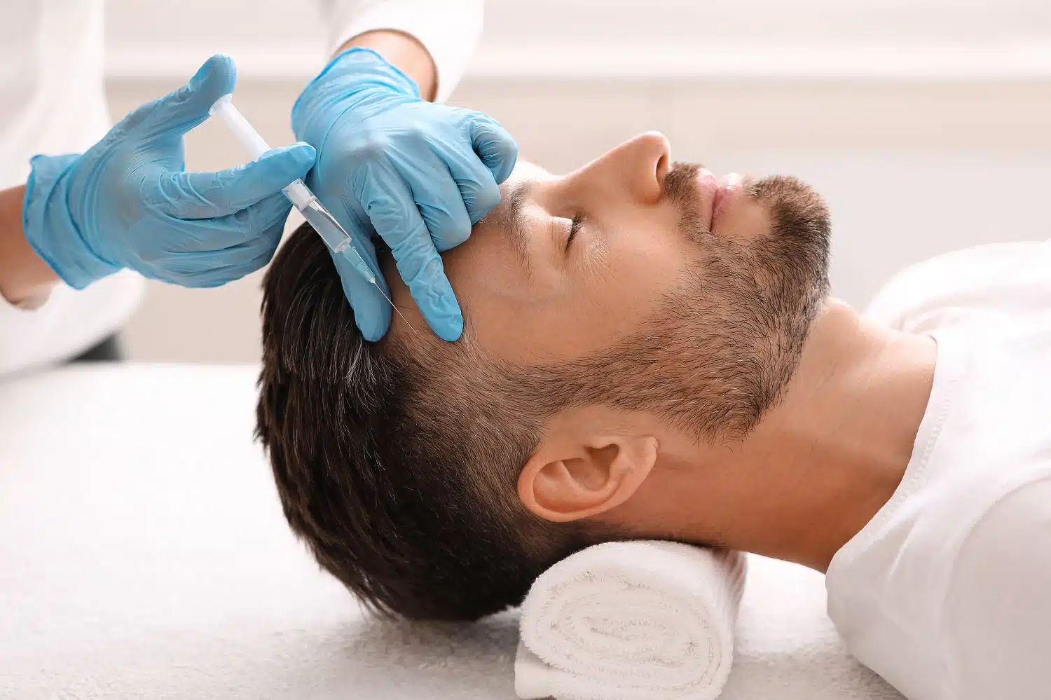 Mesotherapie-Haare-vorher-nachher