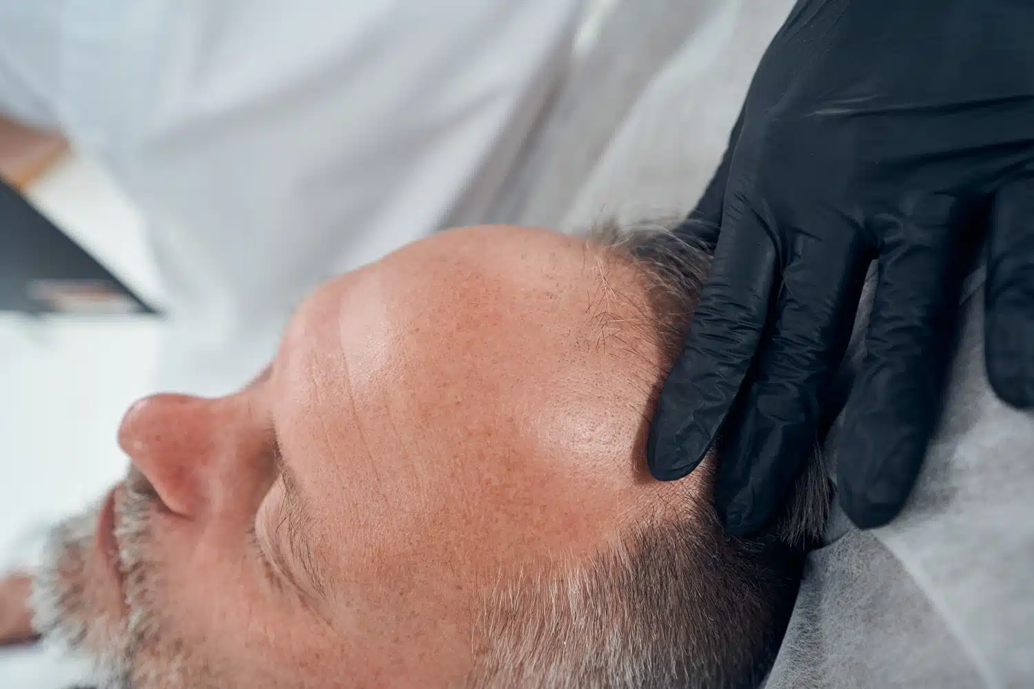 Haarausfall Maenner ab 50