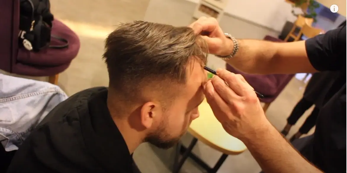 Haarlinie beim Mann