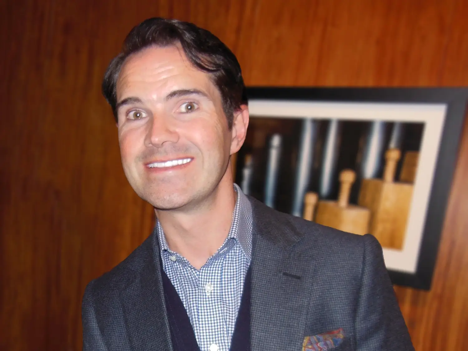Jimmy Carr hair transplant