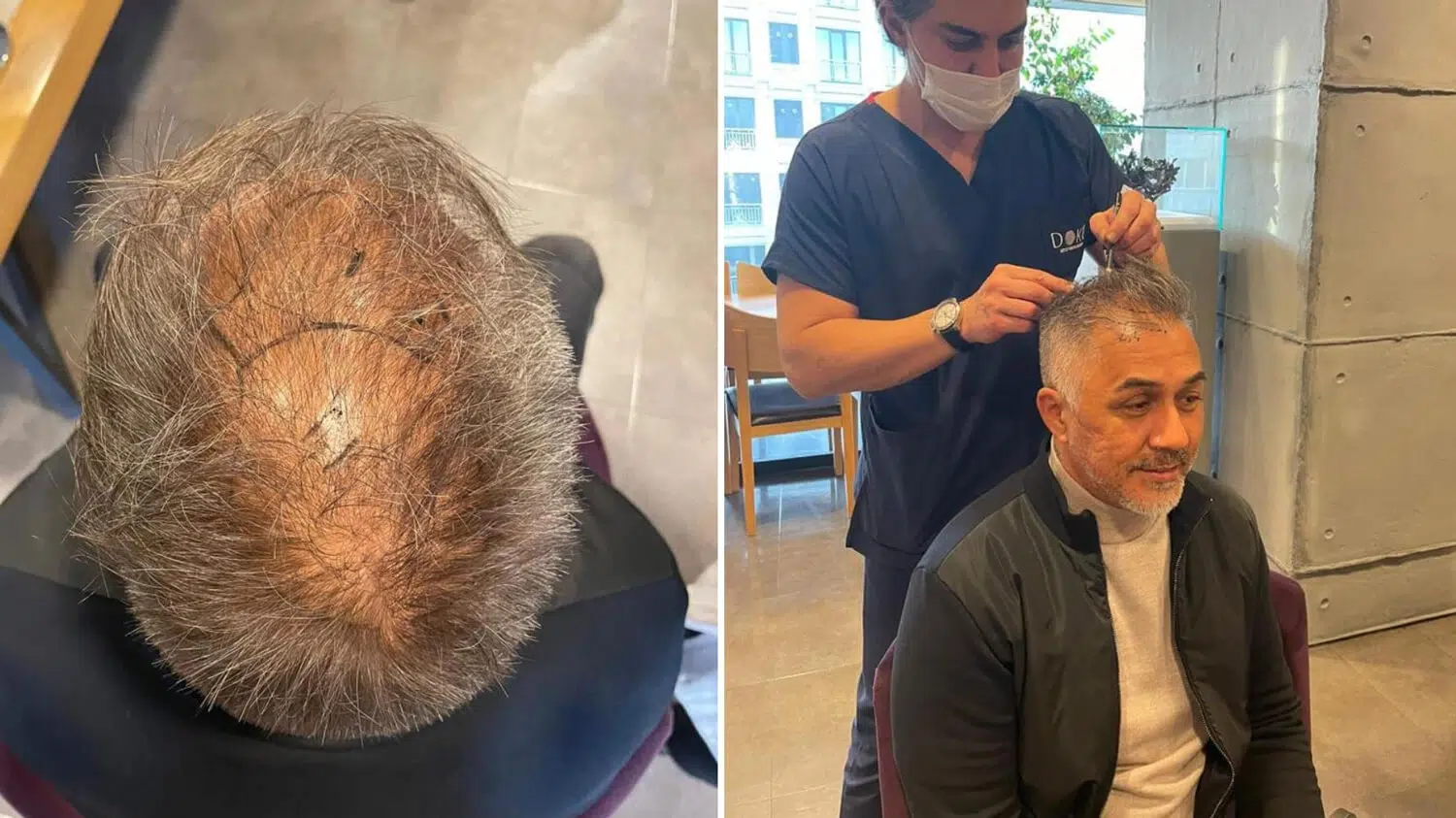 Mike Leon grosch neue Haare