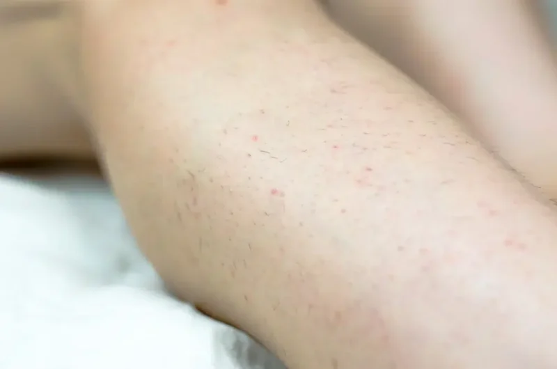 peli incarnati su gamba di donna