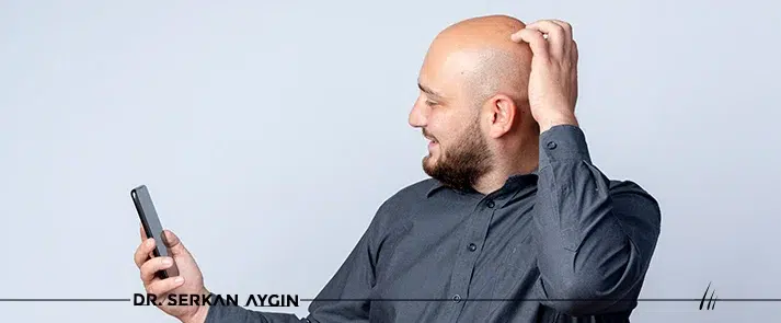 30 yaş üstü saç ekimi rehberi: Dr. Serkan Aygın önerileri (2025)