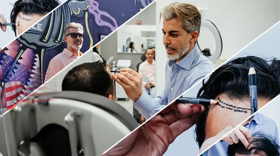 Hastanın sağlık durumu ve Dr. Serkan Aygın değerlendirmesiyle saç ekimi uygunluğu