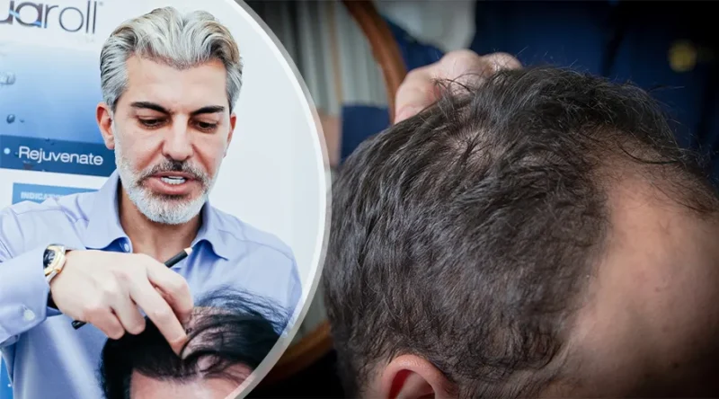 DHI (Direct Hair Implantation) tekniği üzerine kapsamlı inceleme