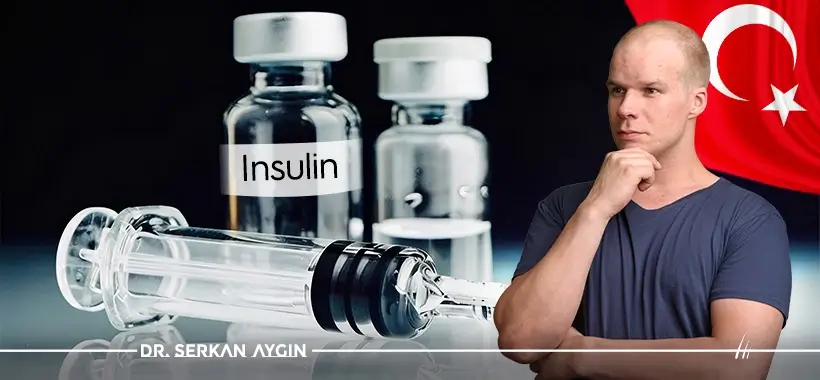 FUE Hair Transplant and Diabetics