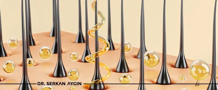 Saç ekimi iyileşme süreci Dr. Serkan Aygin