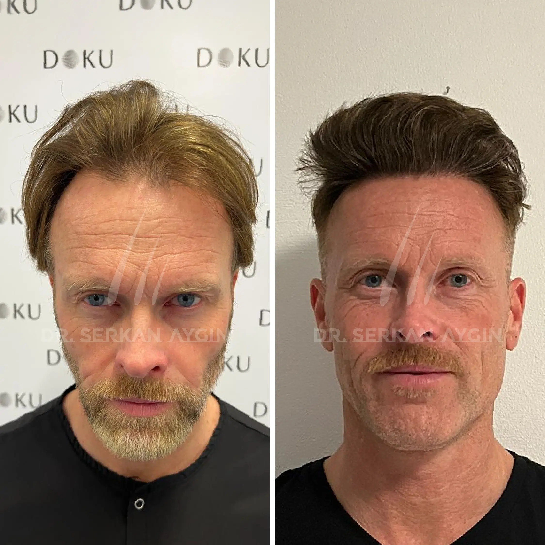 Image is not available