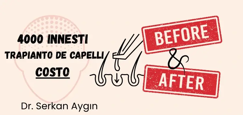 prima e dopo 4000 innesti