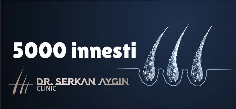 5000 innesti