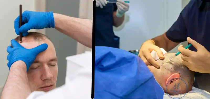 judd before and after 4000