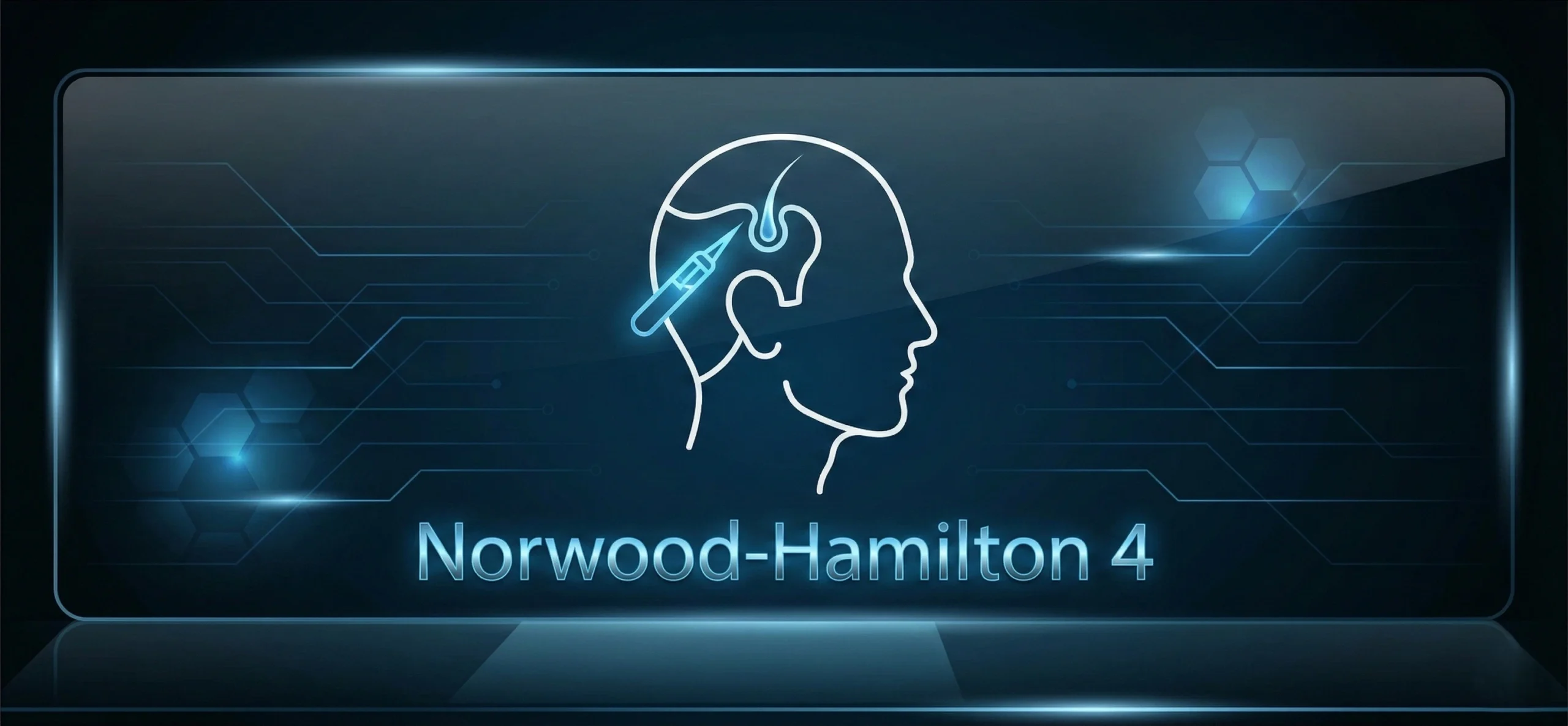 Noorwood+H+4