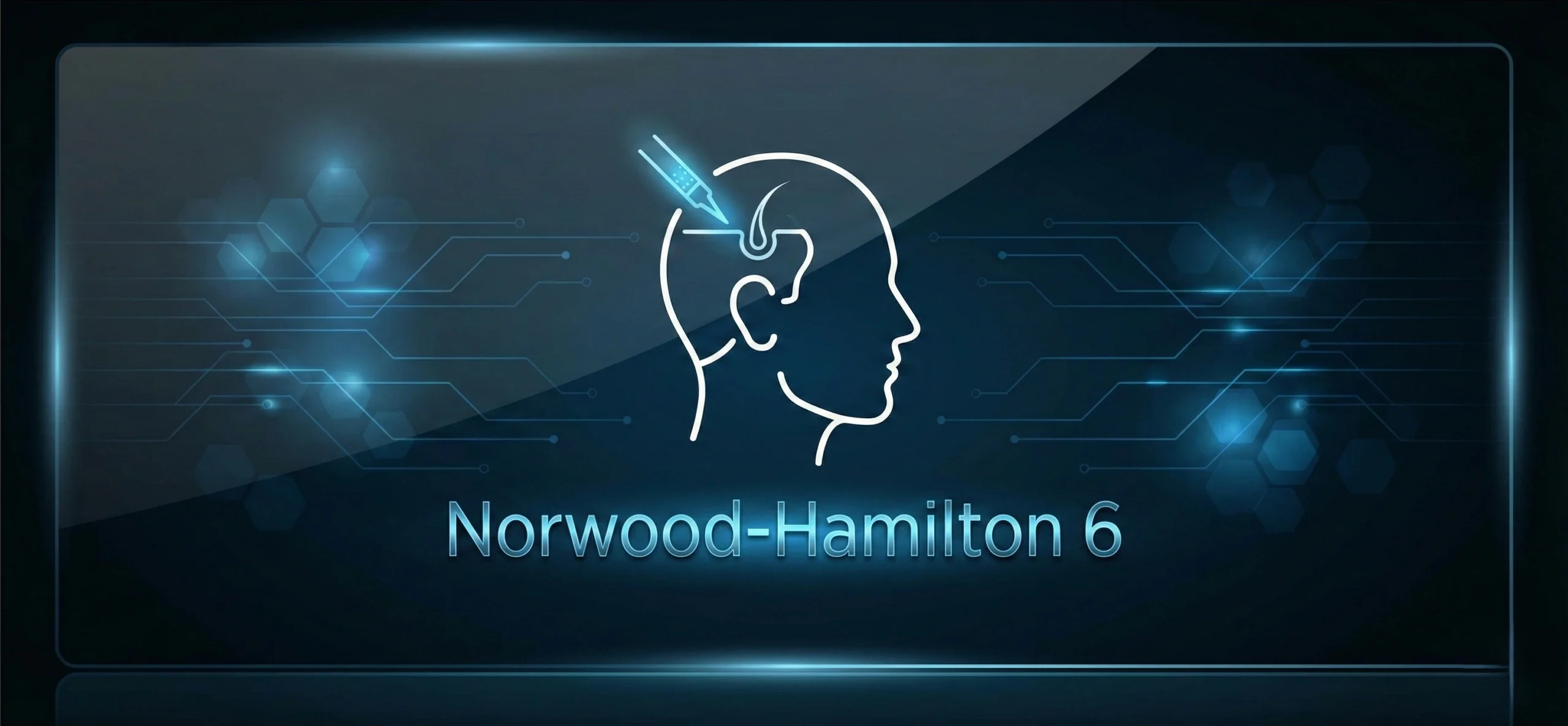 Noorwood+H+5