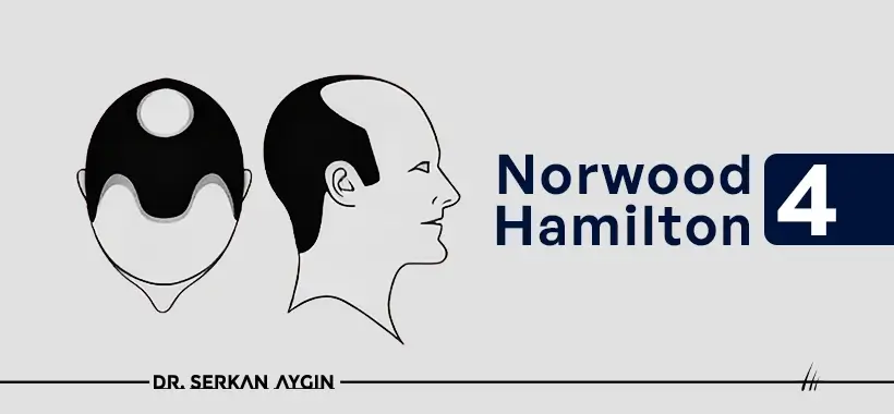 Norwood Hamilton 4
