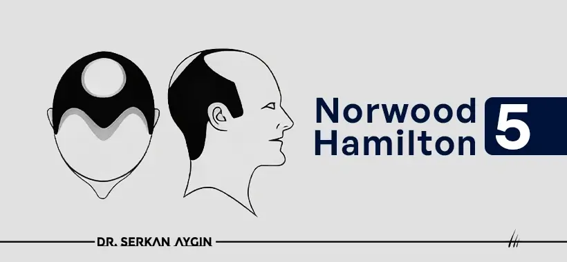 Norwood Hamilton 5