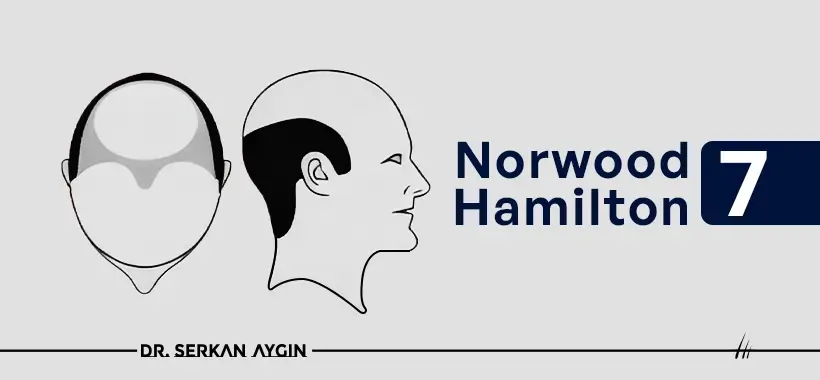 Norwood Hamilton 7