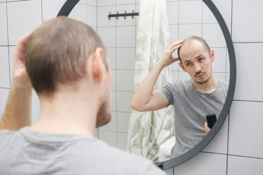 age for hair transplant