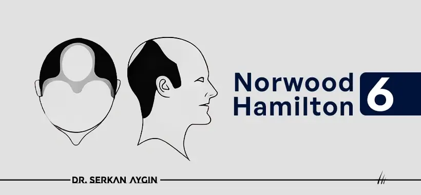 Norwood Hamilton 6