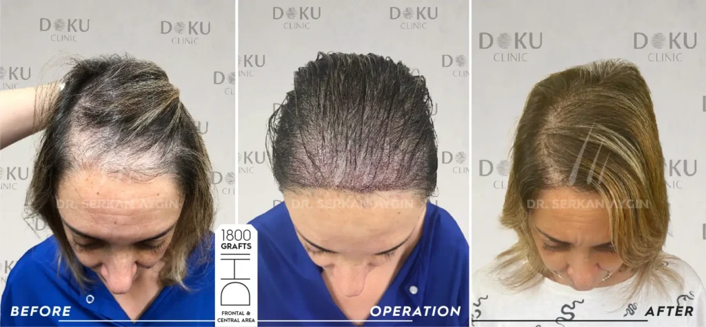 female 1800 Before and after