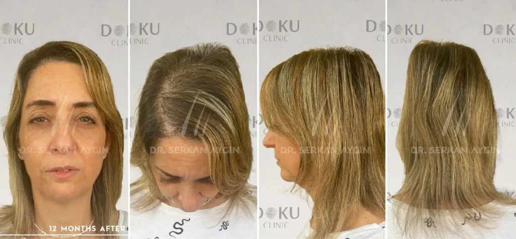 female 1800 Before and after