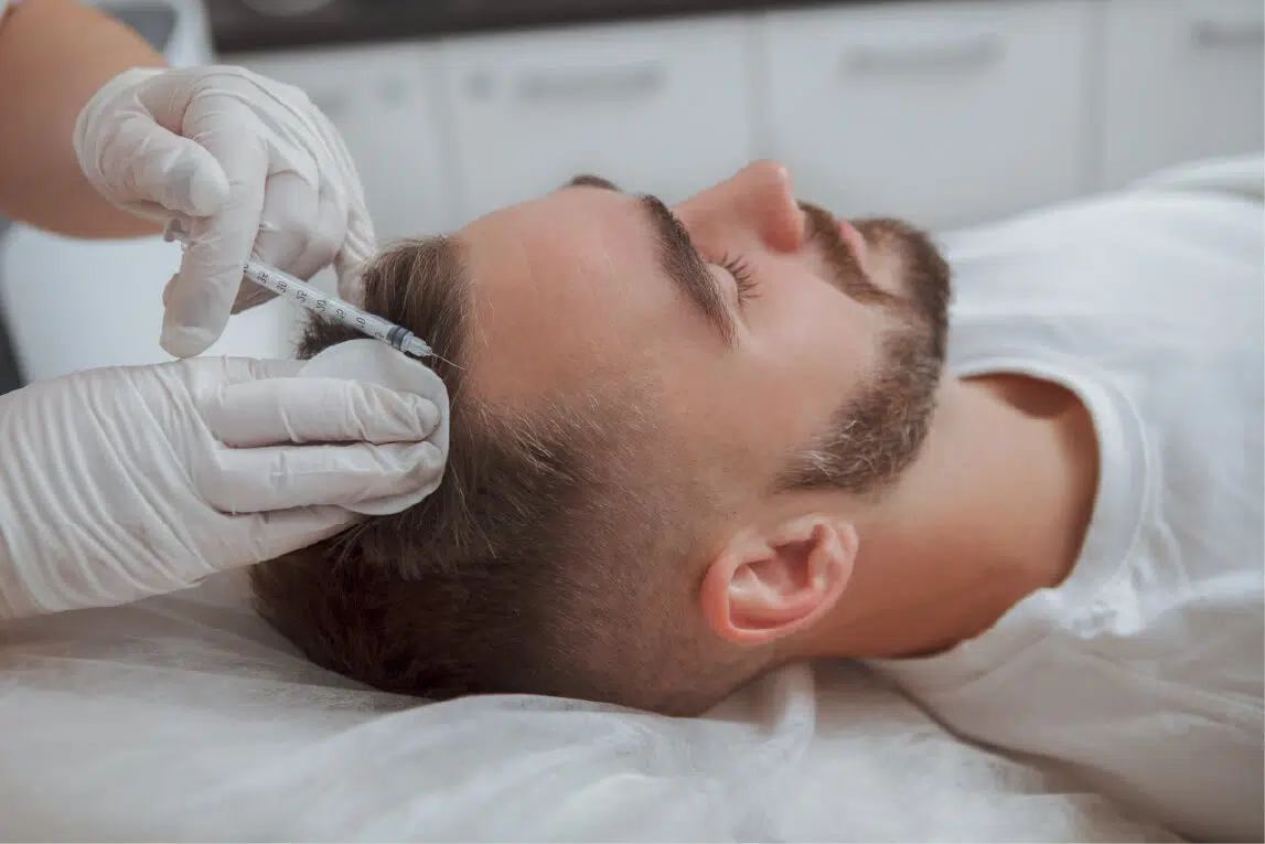 Autologous Exosome Treatment for Hair Loss in Turkey by Dr. Serkan Aygin